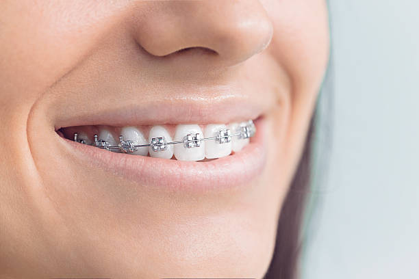 Why Choose Us for Your Dental Needs in Pagedale, MO